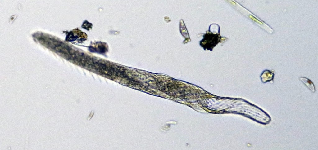 Ciliate Spirostomum ambiguum