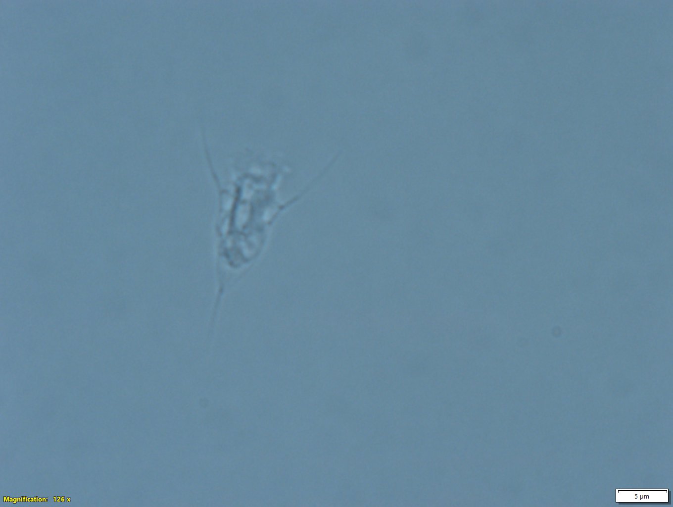 protist