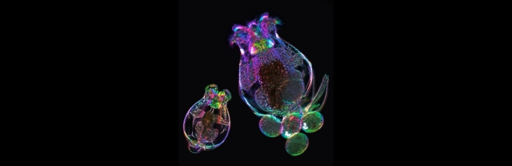 Two microscopic rotifers 