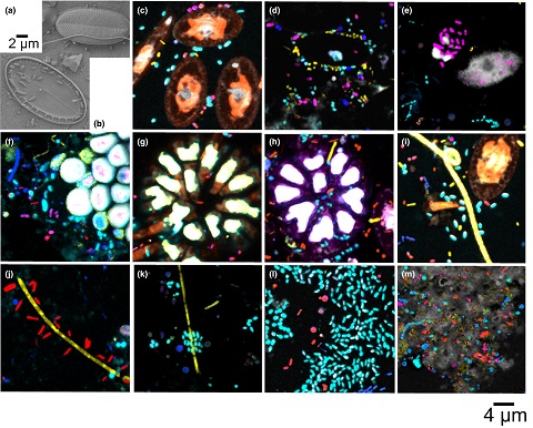 Scanning electron micrographs and (c–m) CLASI‐FISH images of Plastisphere diatoms and bacterial cells sampled from the North Atlantic Ocean and the Tropical Atlantic Ocean.&