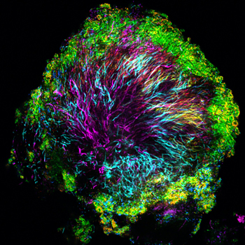 The microbiome in the human mouth will serve to validate t-RNA seq for studying microbial community responses to environmental change.