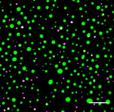 Distinct protein droplets form with different RNA. Credit: E.M. Langdon et al., Science, 2018