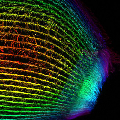 Cilia on the single-celled organism Stentor. Credit: Aidan Fenix, MBL Physiology Course