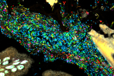 Bacteria in a model human gut microbiome established in a germ-free mouse. Each bacterial species is lit up with a different colored probe, creating a map of the community's spatial organization. Credit:  Jessica Mark Welch and Yuko Hasegawa, MBL