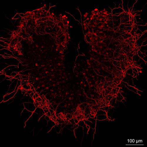 Neurons in Love - In vitro culture of spiral ganglion neurons from the cochlea of the inner ear. Image taken with Zeiss LSM880 with Airyscan in BIE course 2017. Courtesy of Mirko Scheibinger