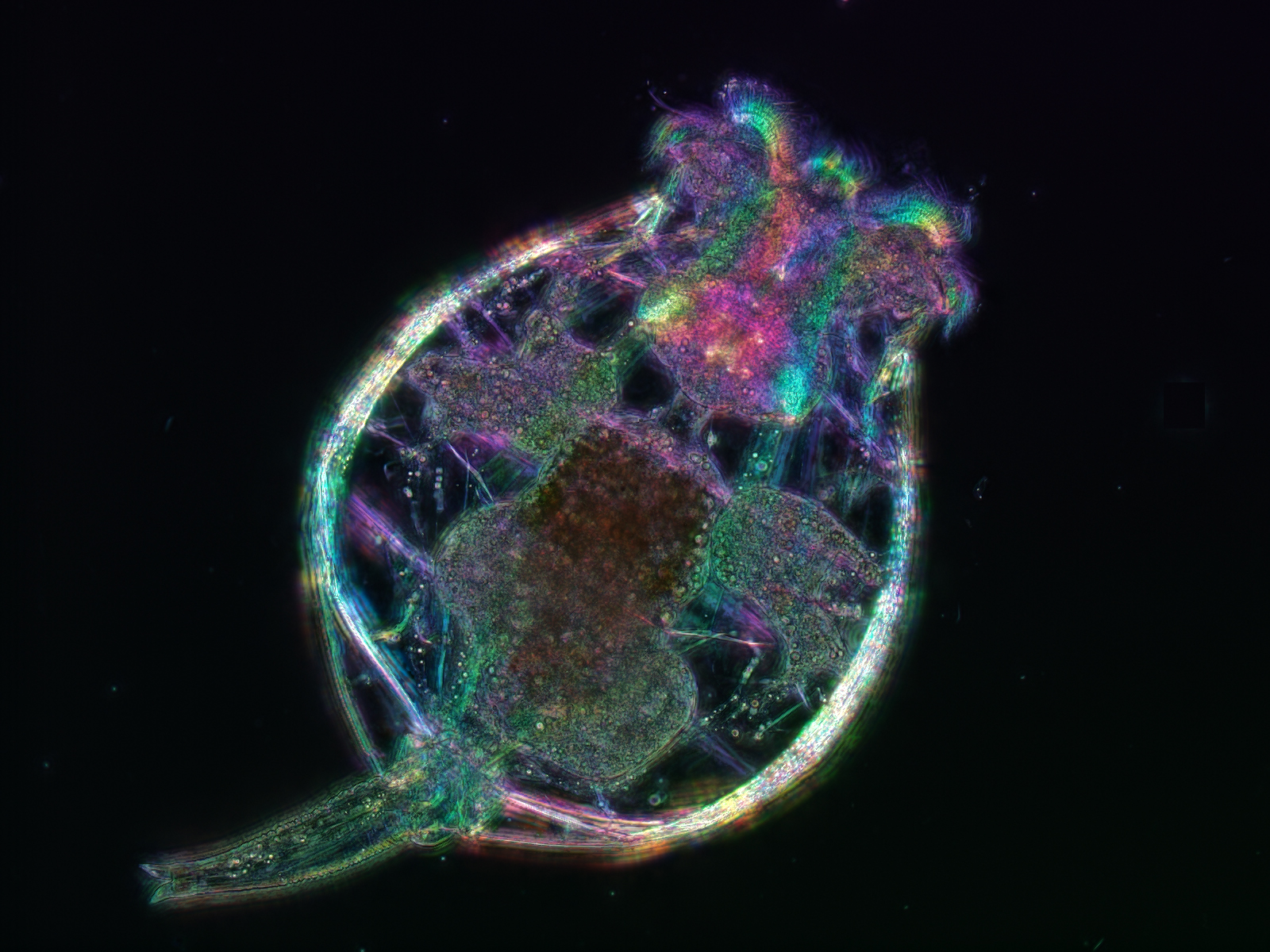 Rotifer. Credit: Kristin Gribble and Michael Shribak