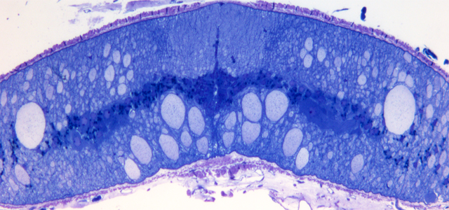 Cross-section of an uninjured lamprey spinal cord. Credit: Paul Oliphint and Jennifer Morgan