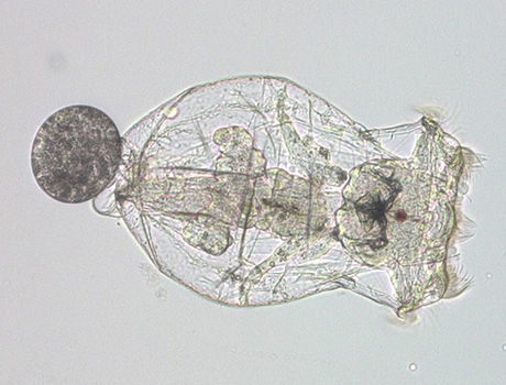 Web female Brachionus manjavacas rotifer with egg by Kristin Gribble