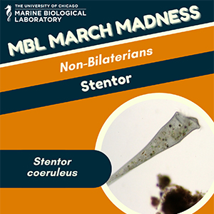 MBL March Madness: Stentor (Stentor coeruleus)