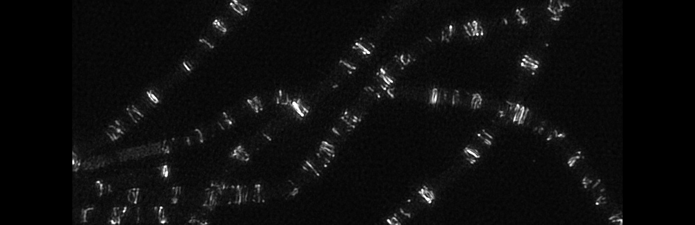 A 3D structured illumination microscopy image of Z rings in the absence of FtsZ binding proteins. Taken during the 2017 Physiology Course on the DeltaVision OMX SR. Credit: Victoria Yan & Georgia Squyres / MBL Physiology