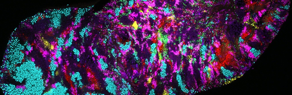 bacterial biofilm scraped from tongue