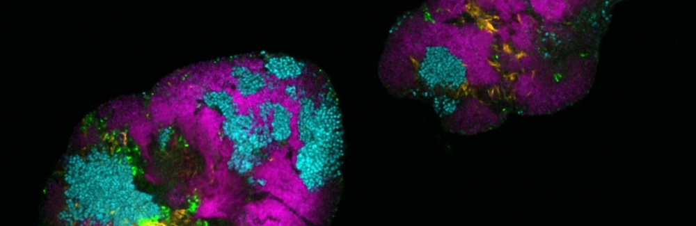 Bacterial biofilm from a human tongue