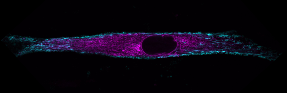 Myoblasts (muscle cells) from mice offer a window into the function of nuclear movement. Credit: Raquel Pereira (@Pereira_ARR)