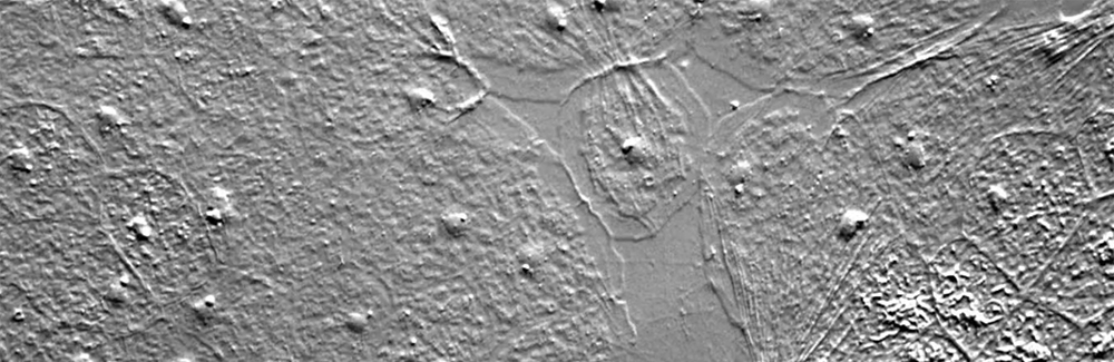 C. hemispherica jellyfish cells caught in the act of re-sealing a wound. Credit: Jocelyn Malamy 