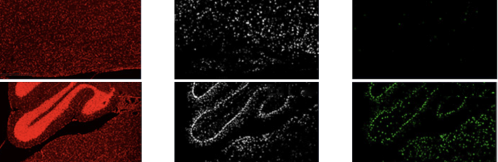 Rett Syndrome in mice brainstem