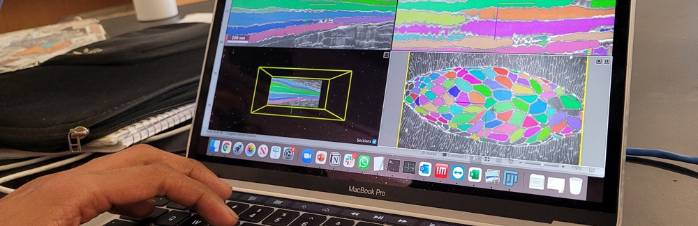 Scene from  MBL Deep Learning Course Credit Anh Phuong Le