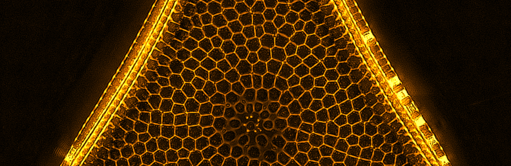 Diatom Trigonium taken on OI DIC microscope