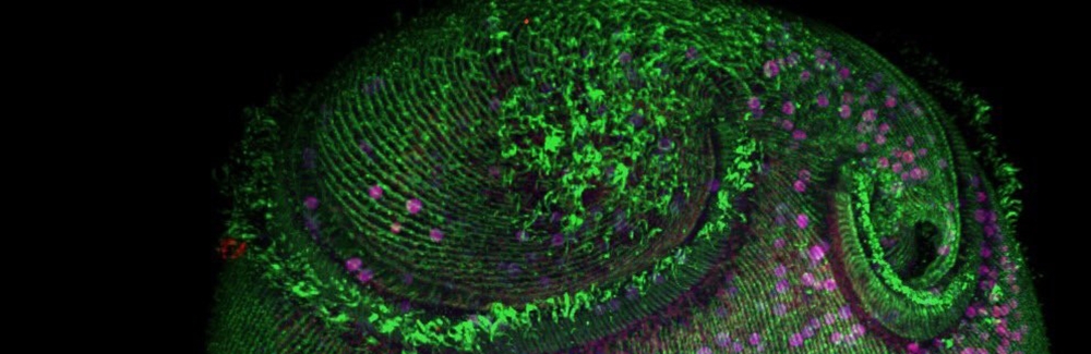 Stentor pyriformis image