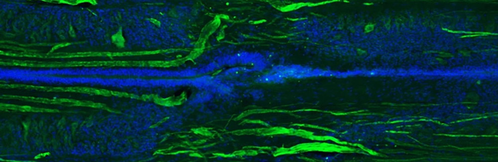 Eleven weeks after being cut, a lamprey’s spinal cord shows regrowth of some of its nerve fibres (green) and the tube-like central canal (blue). Credit: S. Allen and J. Morgan