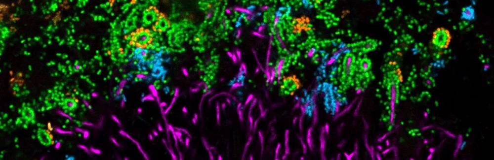 This dental plaque structure, dubbed “hedgehog” for its appearance, shows several genera of bacteria: Corynebacterium (magenta), Porphyromonas (cyan), Streptococcus (green), and Haemophilus/Aggregatibacter (orange).