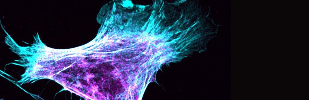 A migrating fibroblast shows myosin in purple and actin in blue. Image courtesy Patrick Oakes