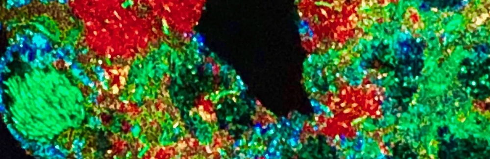 A University of Chicago student’s dental plaque bacteria, imaged with assistance from MBL’s Jessica Mark Welch in the Visualization and Biology course. Photo courtesy of Ege Yalcindag