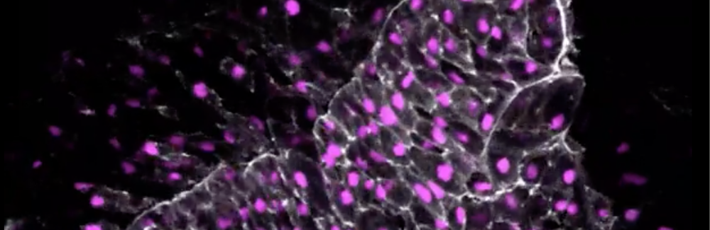 The cellular skeletal protein actin (grey) marks the cell edges and the nucleus is is in magenta.