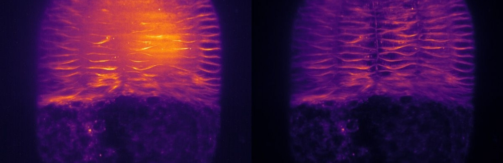 microscopy image of butterfly ovary