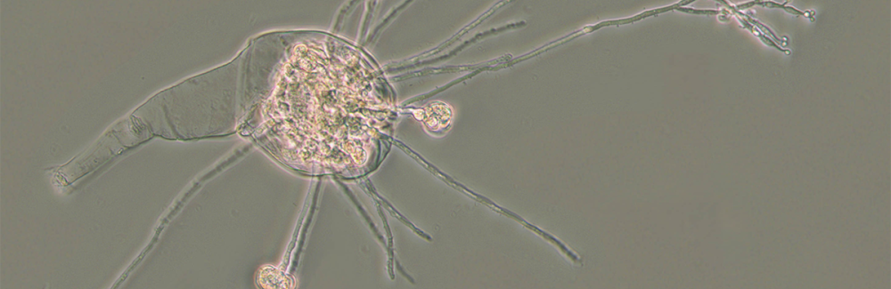 bdelloid rotifer infected by fungus