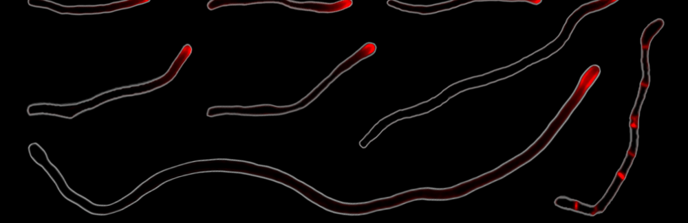 Cellular elongation at the tips of the filamentous bacteria Corynebacterium matruchotii. Credit: Chimileski et al (2024).