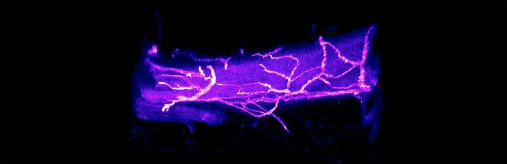 A screenshot of an imaging video of the giant axon in the longfin squid (D. paelli). Credit: Credit: Miguel Holmgren, NIH; Bill Green, University of Chicago; Rylie Walsh, MBL
