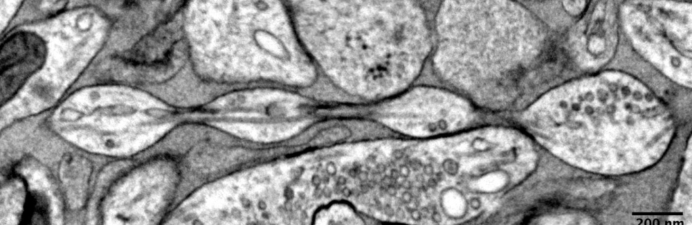axon