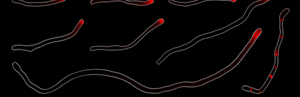 Cellular elongation at the tips of the filamentous bacteria Corynebacterium matruchotii. Credit: Chimileski et al (2024)