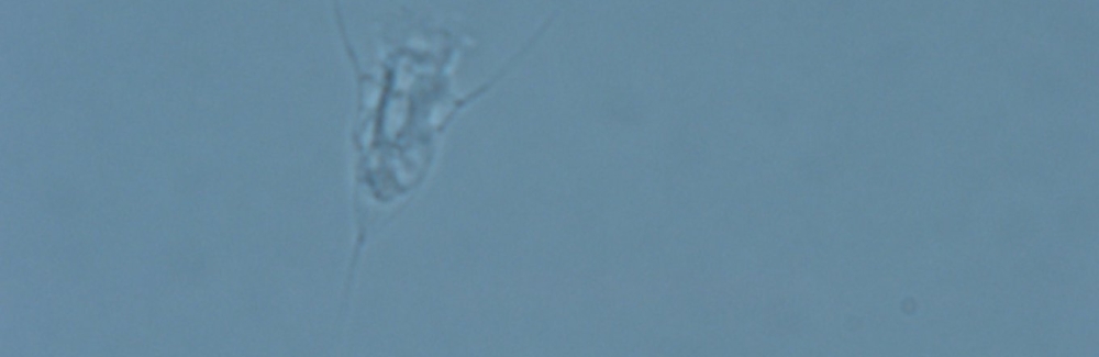 protist