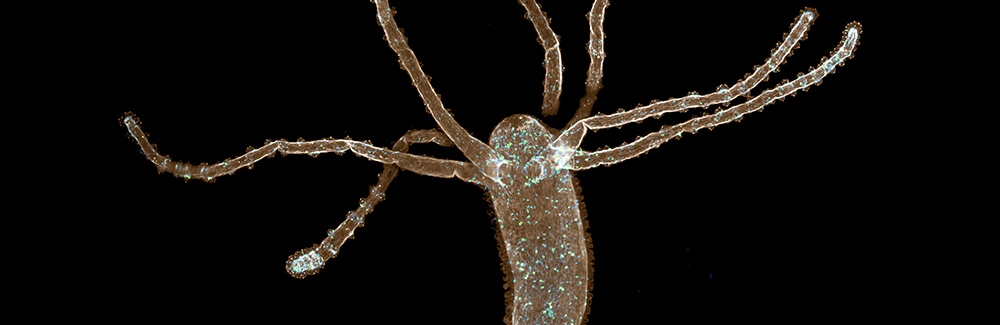 Hydra muscle fibers in sepia and_neurons in blue-green Credit John Szymanski