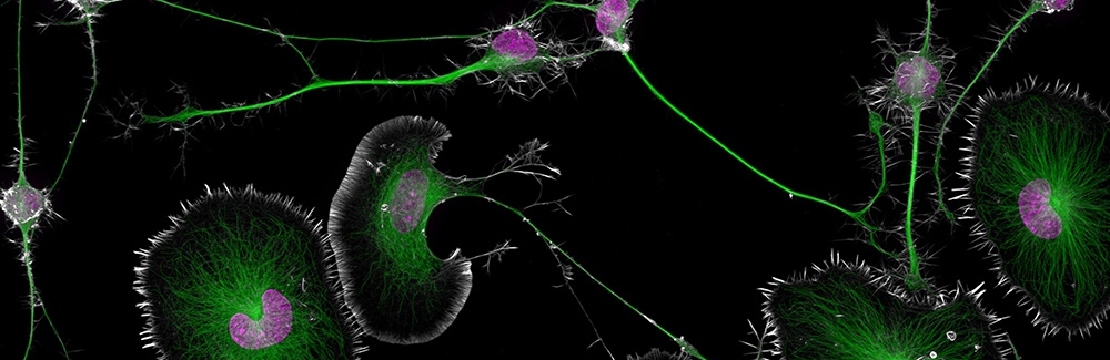 mouse brain cells