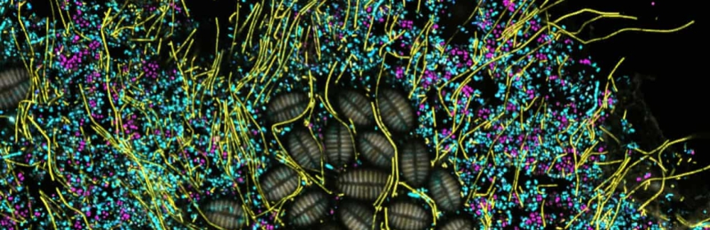 microbes