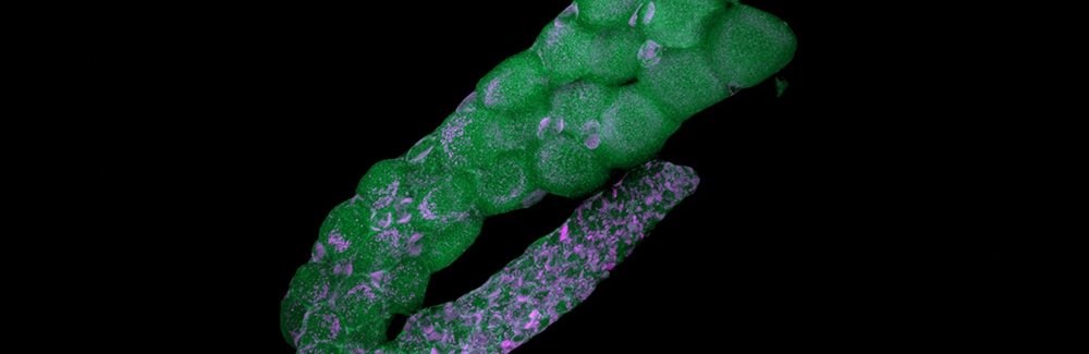 ostracod ovarium with endosymbiotic bacteria