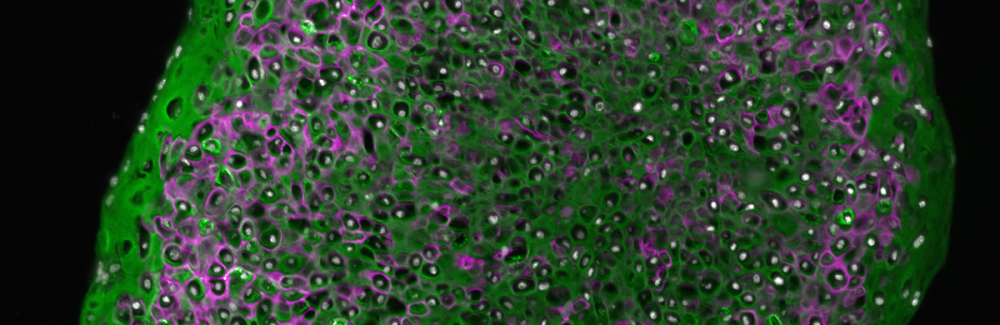 Round cross sectional image of an pearl shaped organoid with some cells stained green and others purple.