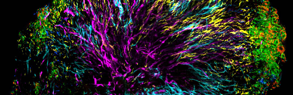 A colorful microscopy image showing a branching tree structure of bacteria.