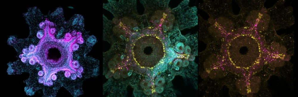 Three sea stars under a microscope with fluorescent colors.