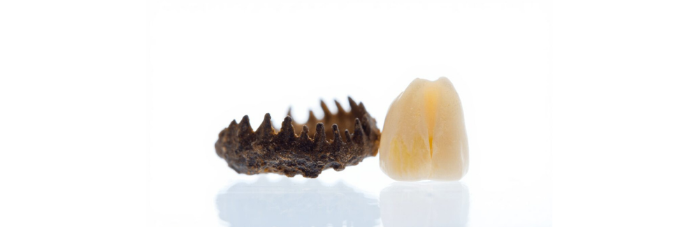 Fish scale next to a human tooth for comparison