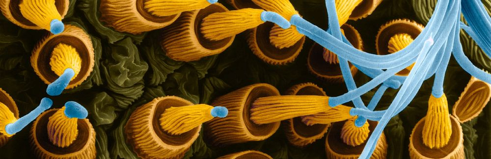 A scanning electron micrograph of spider silk spigots 