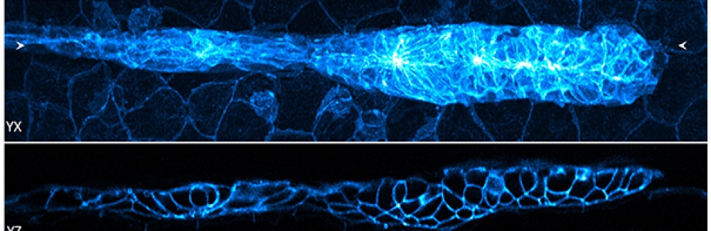 Lateral and axial images of 32-hour zebrafish embryo, marking cell boundaries within and outside the lateral line primordium.