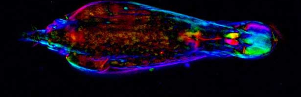 Bdelloid rotifer Adineta vaga in motion under video-enhanced polychromatic polarization microscope