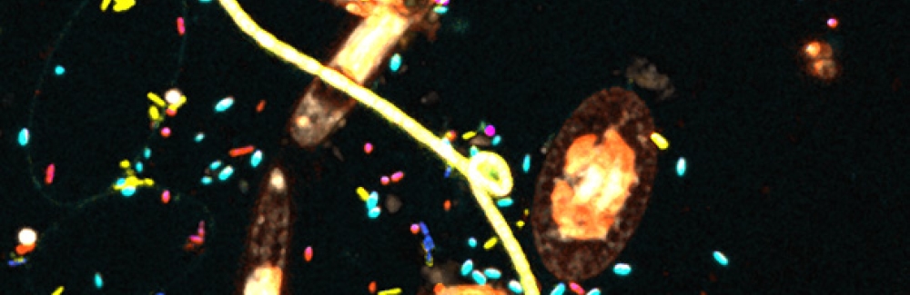 Plastisphere-sample-from-Vineyard-Sound