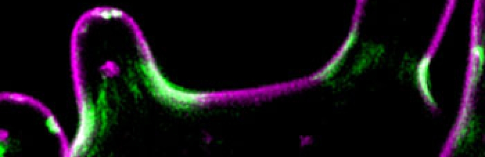 The filamentous fungus Ashbya gossypii. The plasma membrane is visualized in magenta (FM-464), and the septin Cdc11a-GFP is in green.