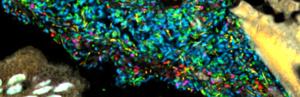 Bacteria in a model human gut microbiome established in a germ-free mouse. Each bacterial species is lit up with a different colored probe, creating a map of the community's spatial organization. 