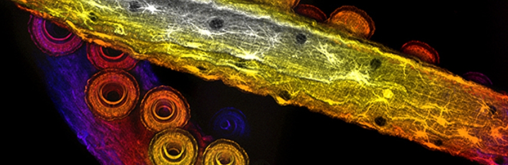 Imaging photo of Arm muscles of Octopus bimaculoides