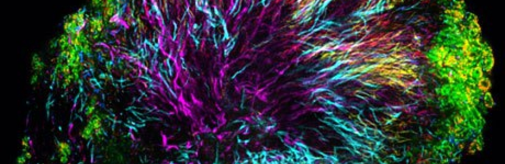 A “hedgehog” structure in dental plaque, collected from a healthy volunteer using a toothpick. Corynebacteria, shown in magenta, form the core of the structure; other bacteria inhabit the structure at characteristic positions.